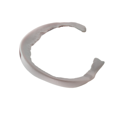 MeniscusDeficient_PreOp_Meniscus.png