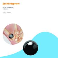 PYROSPHERE Surgical Technique