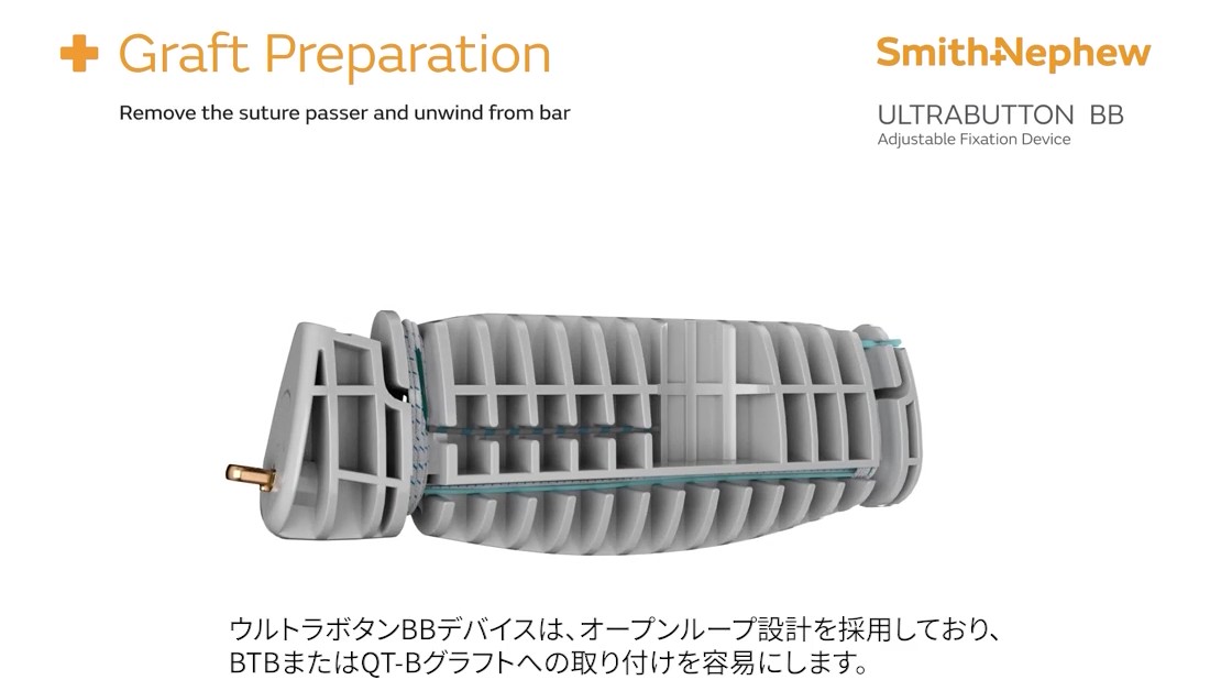 【動画】ULTRABUTTON BB - frame at 0m12s.jpg