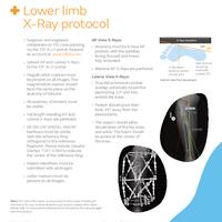 TSF ALLY Lower Limb X-Ray Protocol