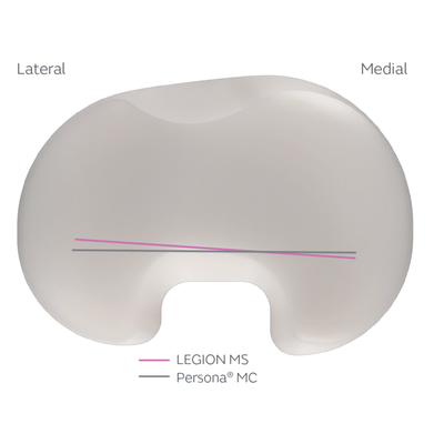 LEGION-TKS_Medial Stabilized_Web_3.png