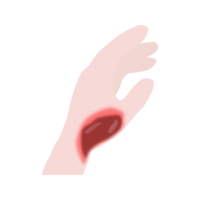 Icon - Consumer - Third Degree Burns