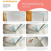 HEALICOIL Knotless selbst-schneidend, OP-Technik Übersicht (22198-de)