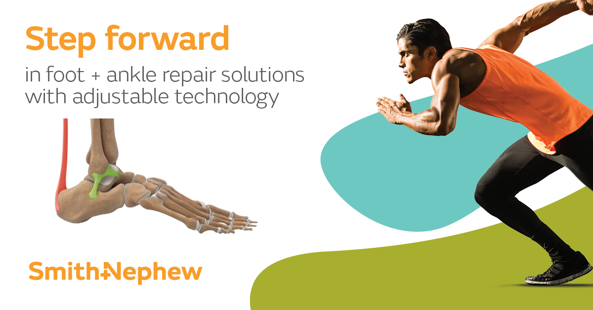 Step forward in foot & ankle repair solutions with adjustable technology