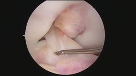 4KO Scopes Visualization