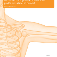 03282_FR_Technique Opératoire Butée sous Arthro- Pr Boileau.pdf