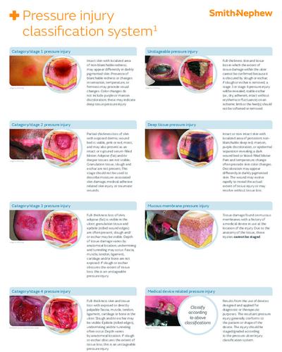 PI classification poster