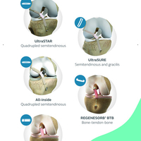 Reimagine Reconstruction Ligament Repair