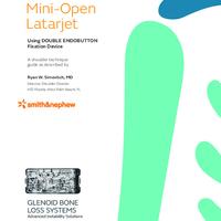 OSTEOCONNECT Mini Open Latarjet technique