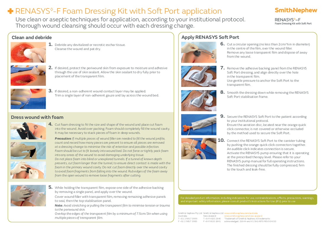 RENASYS F Foam Application Poster
