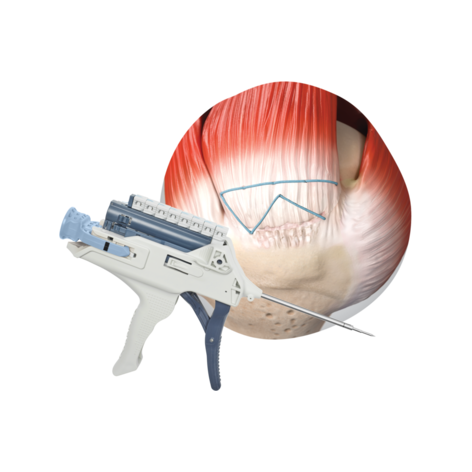 TENDON SEAM Hero Banner