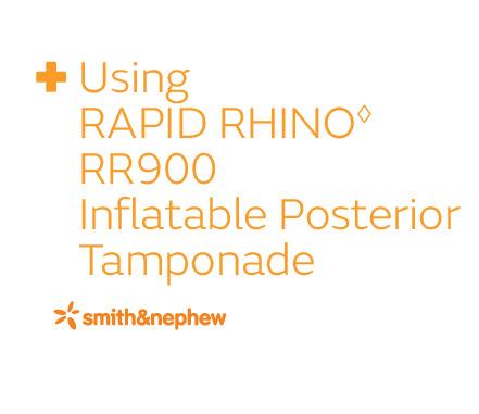 Using RAPID RHINO RR900 Inflatable Posterior Tamponade