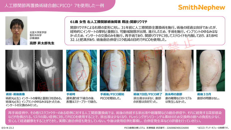 iPICO整形ケースカード_膝_高野先生.png