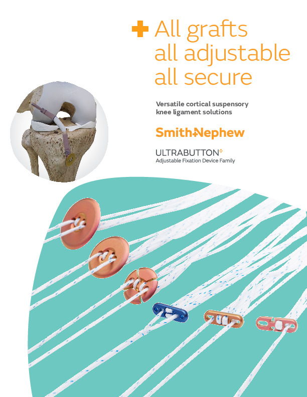 ULTRABUTTON Adjustable Fixation Device Family Brochure