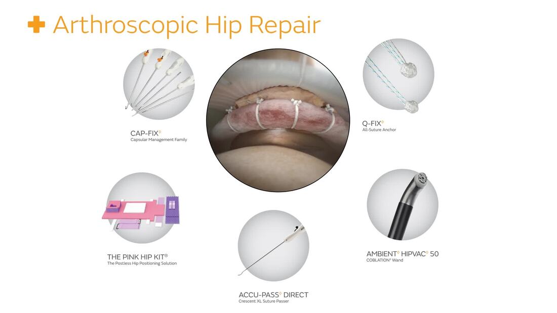ACCU-PASS DIRECT Crescent XL Suture Passer | Smith+Nephew USA
