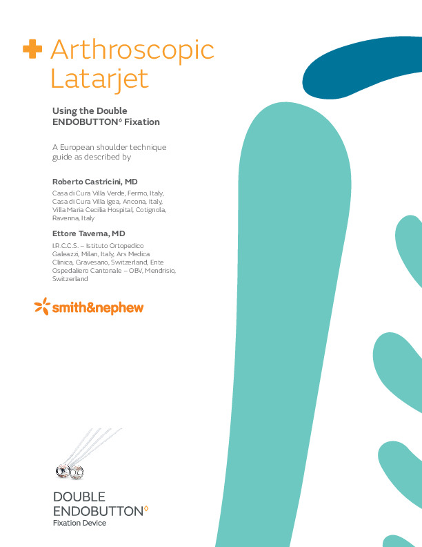 Arthroscopic Latarjet Technique Guide