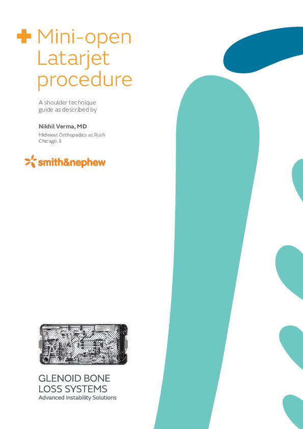 Mini Open Latarjet Technique Guide