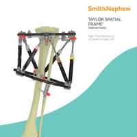 TSF High Tibial Osteotomy