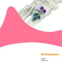 LEOS Lapidus Procedure Surgical Technique