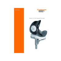 GENESIS II ACF Surgical Technique