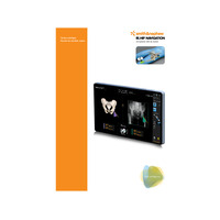 22483_es_V1_RI_HIP_NAVIGATION_Supine_Position_Surgical_Technique_0720_LR_pdf_873025.pdf