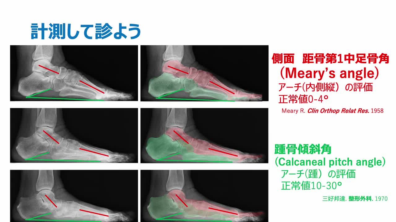 サムネ1.jpg