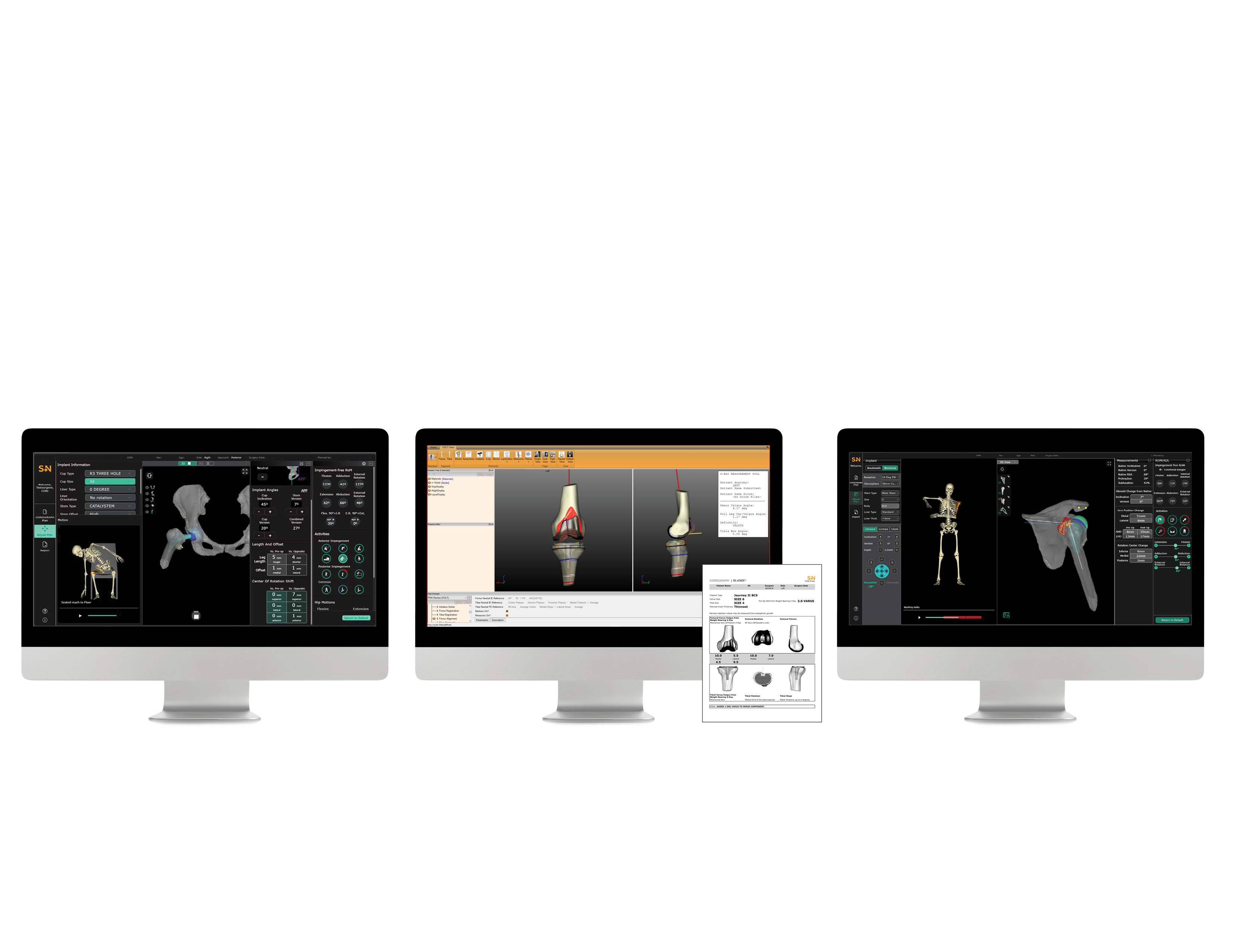 CORIOGRAPH Web Page Content - Hero Image