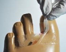 RENASYS ジェルパッチ