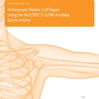 67691a.en-multifix-s-ultra-knotless-suture-anchor-technique-guide.pdf