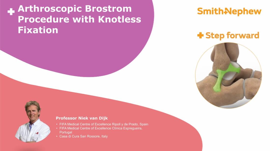Arthroscopic Brostrom with Knotless Fixation featuring Professor Niek Van Dijk