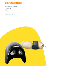 PYROCARBON LUNATE Surgical Technique