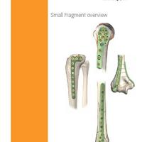 PERI-LOC Ti Small Frag Surgical Technique