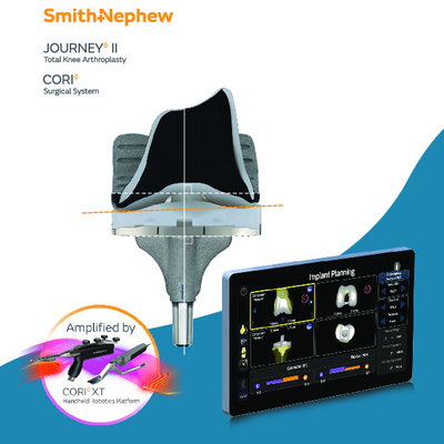 JOURNEY II TKA + CORI Kinematic Alignment Brochure