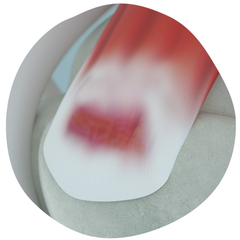 PartialThicknessTear_HeroCutout(24901)_20250211