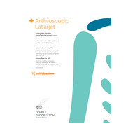 25434-V5-Arthroscopic-Latarjet-TG-digital-0821.pdf