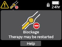 RENASYS EDGE_PATIENT web page_Blockage