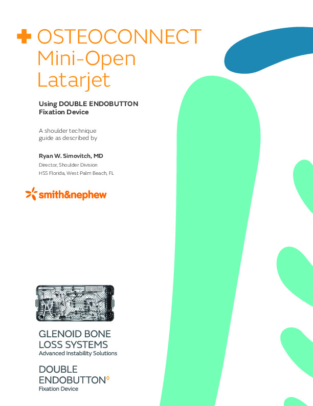 30315-anz-v1-mini-open-latarjet-double-endobutton-simovich-0322.pdf