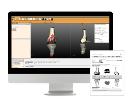 CORIOGRAPH Knee Main Body Image