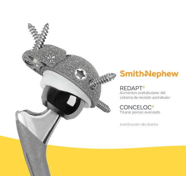 REDAPT Revision Acetabular System Smith+Nephew Global