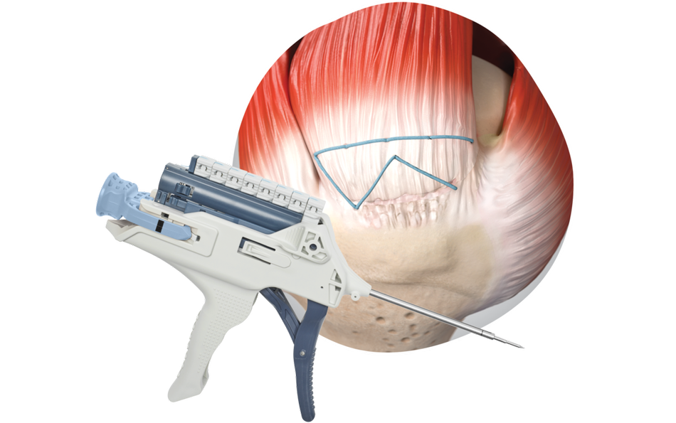 TENDON SEAM Hero Banner