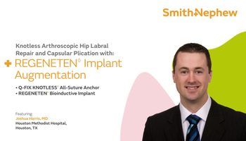 Knotless Arthroscopic Hip Labral Repair and Capsular Plication with REGENETEN
