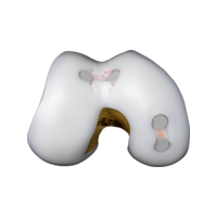 CartiHeal_Case_Implant card.png