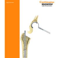 RENOVATION Surgical Technique