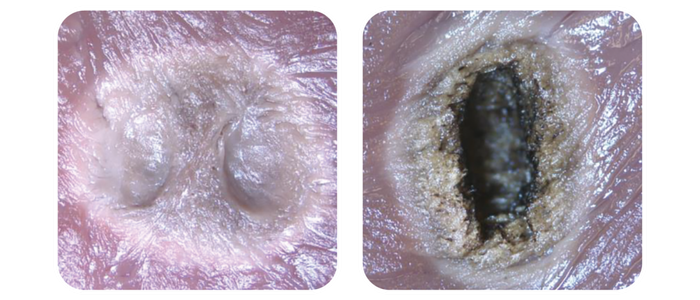 FASTSEAL Webpage clinical evidence4