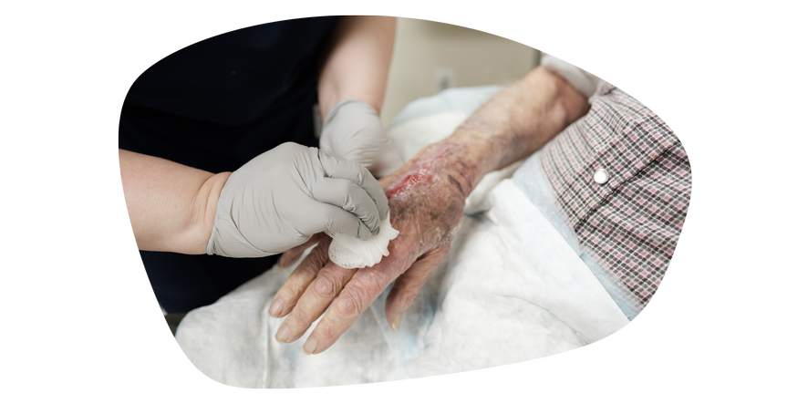 Wound care indications treatment
