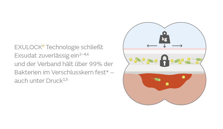 Allevyn Bacteria Lock Bild 2