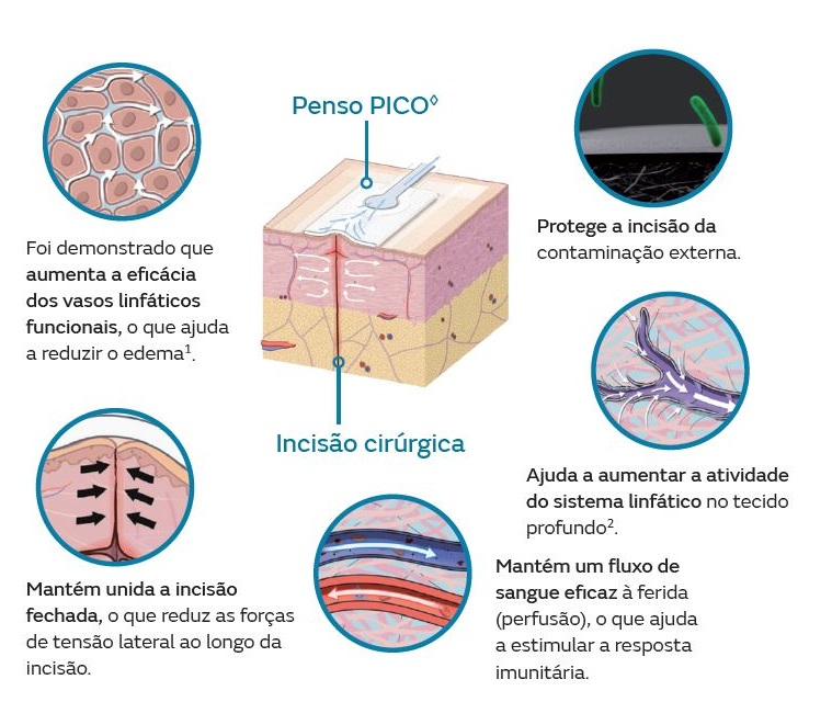PICO Mecanismo de ação