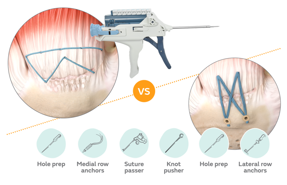 50975-V2-SHO-TENDON-SEAM-Webpage-assets-09265.png