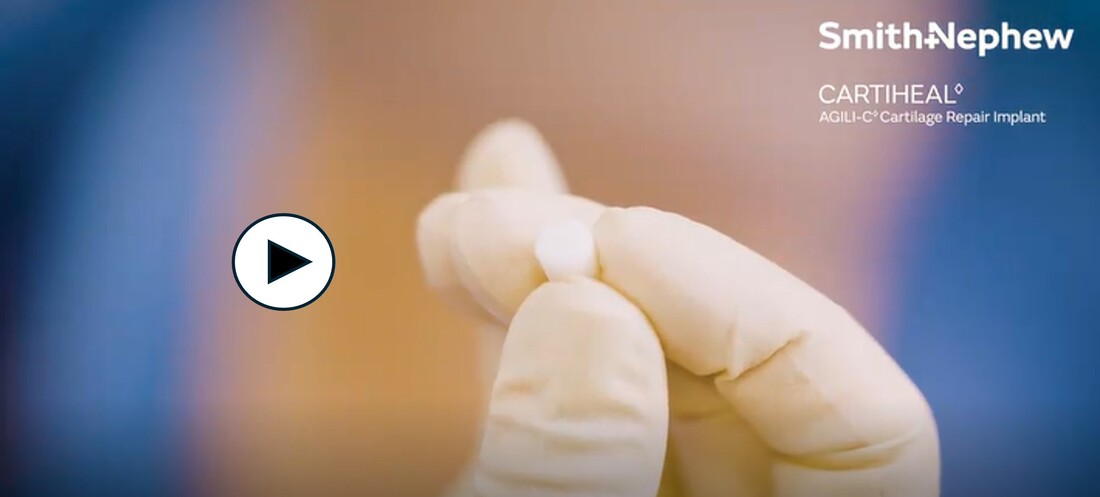 hand wearing surgical glove holding cartiheal implant