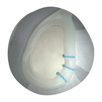 Instability-Excellence2